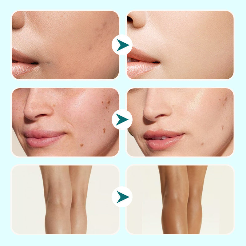 EclatDerm™ Crème Correctrice Hydratante et Résistante à l'Eau | 1+1 Gratuit