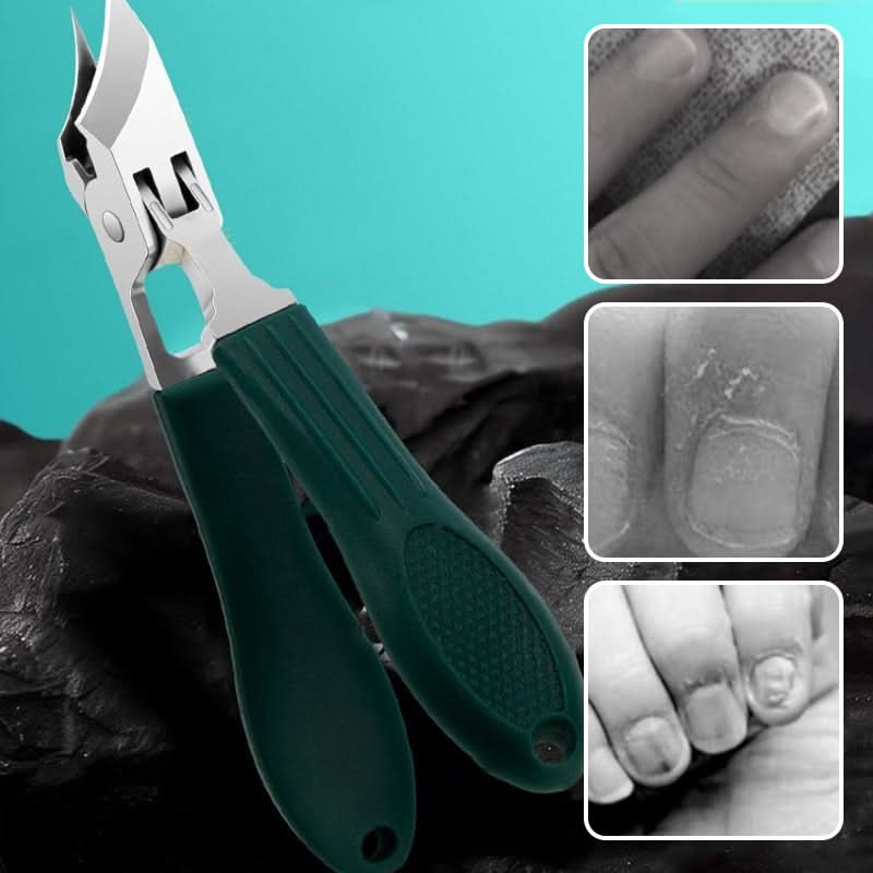 ClipGuard™ - Ensemble de soin des ongles 3 en 1 - Intelligent, Hygiénique & Efficace