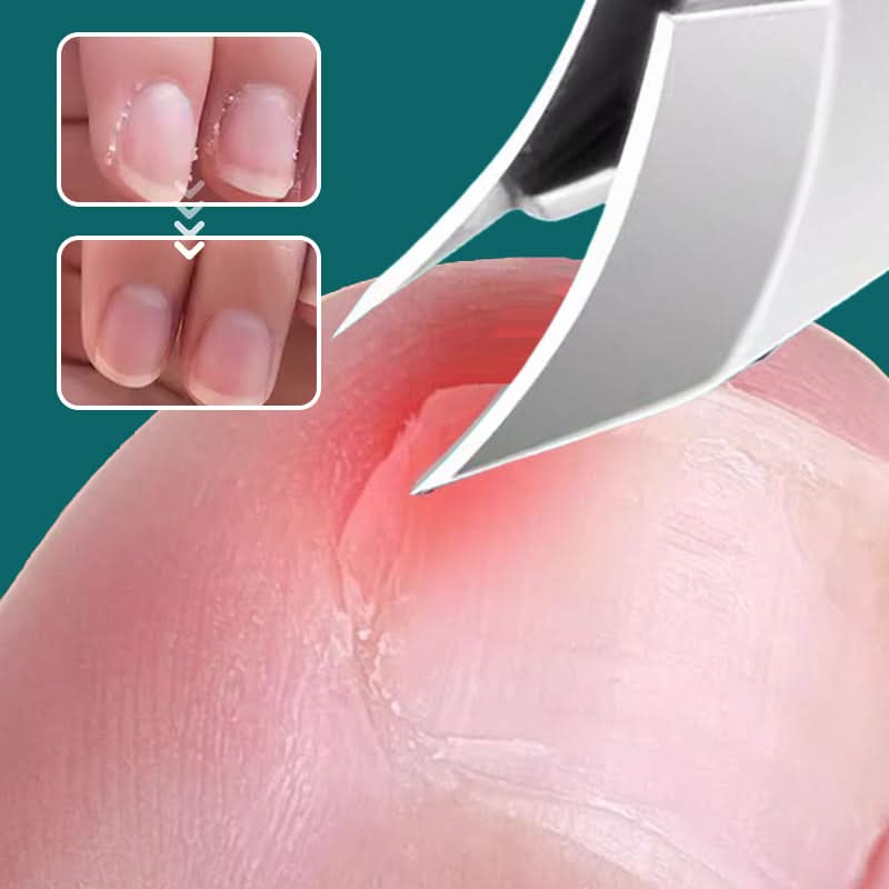 ClipGuard™ - Ensemble de soin des ongles 3 en 1 - Intelligent, Hygiénique & Efficace