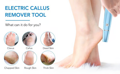 Silkava™ | Râpe Électrique pour Pieds – Douceur & Soin au Quotidien