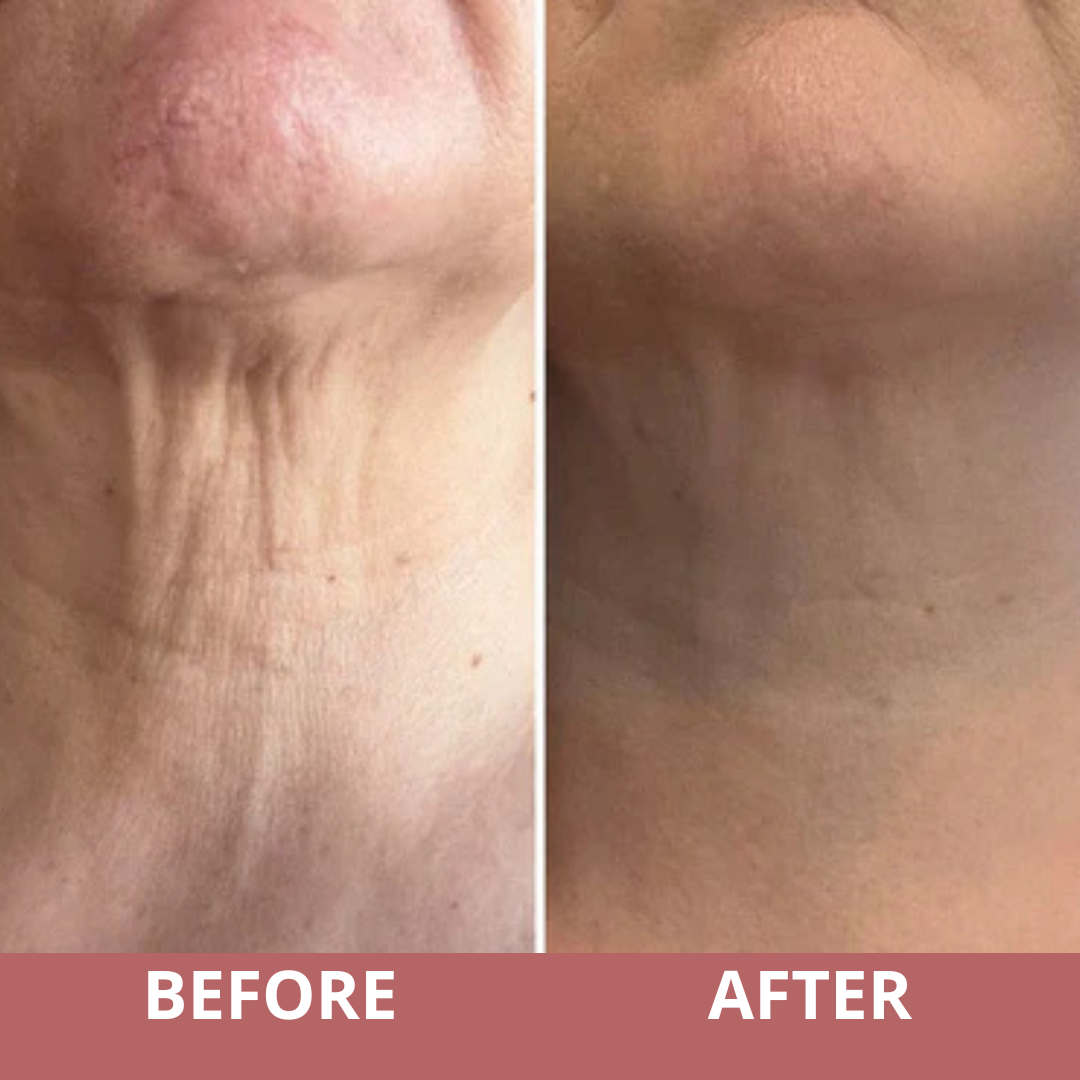 NeckLuxe™ - Crème Raffermissante pour le Cou et le Décolleté