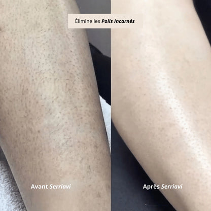 Silvarel™ | Épilateur Doux – Confort & Précision pour Peaux Sensibles