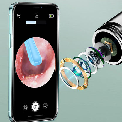 Auris - Le nettoyage d'oreille réinventé par la caméra HD